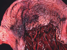 Gastritis hemorrágica (equino)