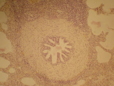 Neumonía parasitaria