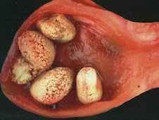 Urolitiasis (cobayo)