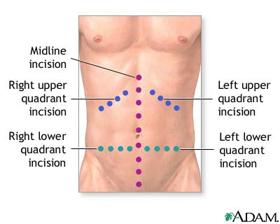 Pain And Spasms In Upper Left Abdomen