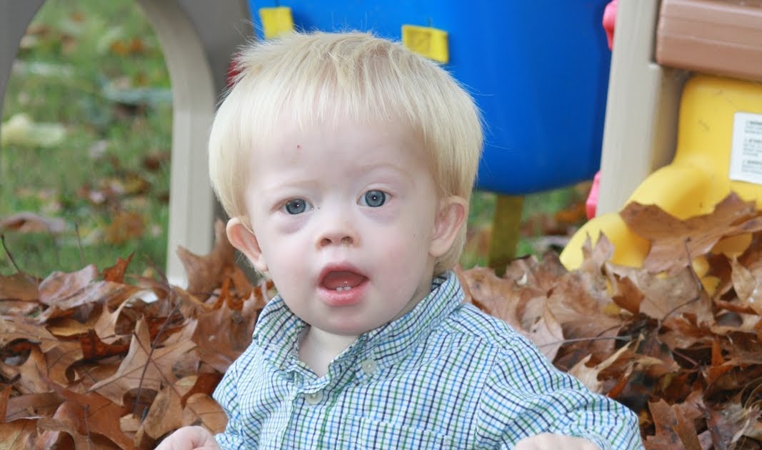 The Hill Family of Northwest Arkansas A Journey Into the World of Down