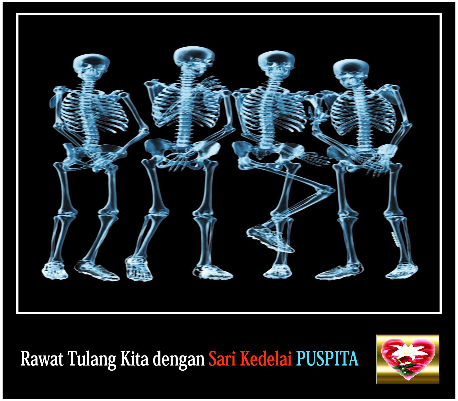 Sari Kedelai Puspita Mencegah Tulang Keropos