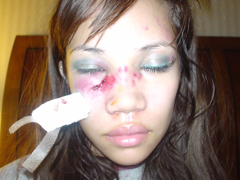 [nilabdaybrokefaceopen.jpg]