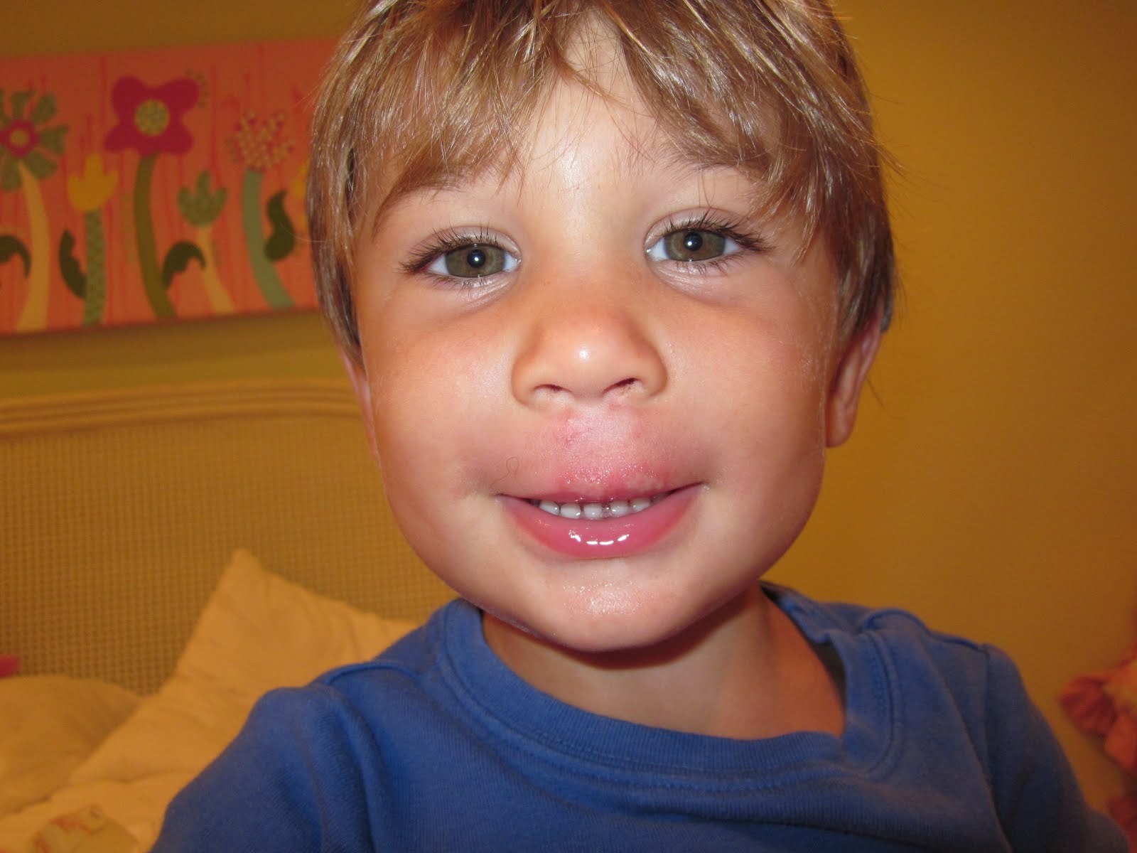 the dunn's 1st Busted Lip