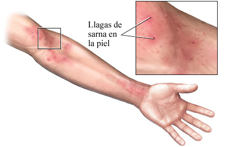 Eficaz los medios del alcoholismo