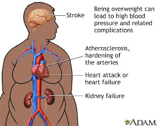 Diseases From Obesity