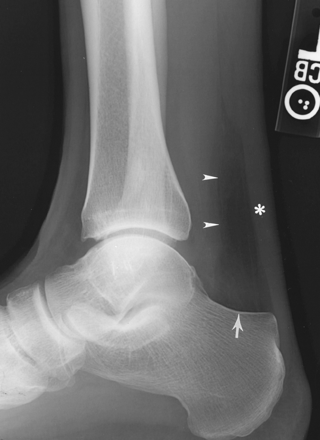 RadiologySpirit