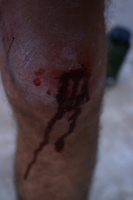 busted knee
