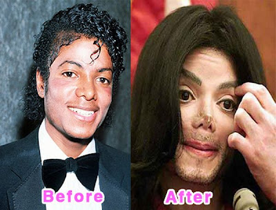 Plastic Surgery Celebrity on Images Of Worst Celebrity Plastic Surgery Before And After