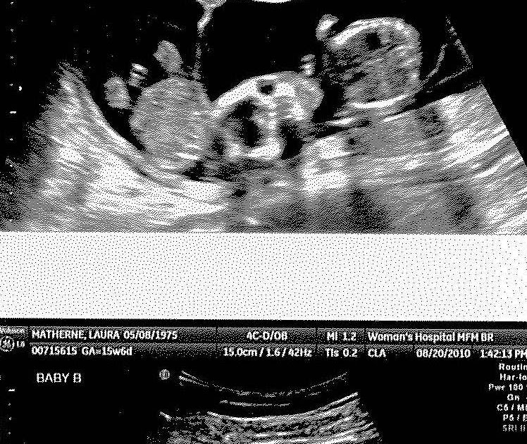 The Matherne Quads! 16 week ultrasound Baby B Its a Boy!