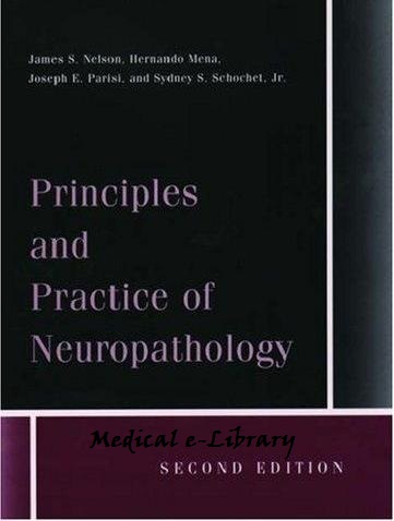 Principles and Practice of Neuropathology Hernando Mena, James S. Nelson, Joseph E. Parisi, Sydney S. Schochet