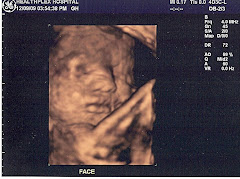 Reece's 3-D picture at 31 1/2 weeks