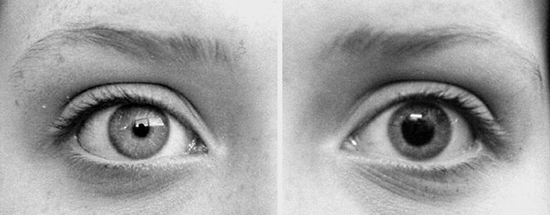 Pupil dilation and attraction