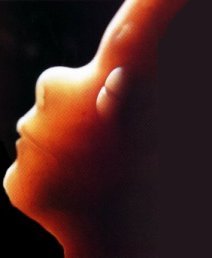 [fetus.jpg]