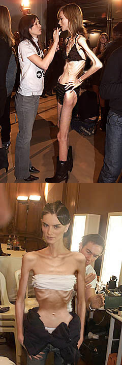 [supermodellid_anoreksia.jpg]