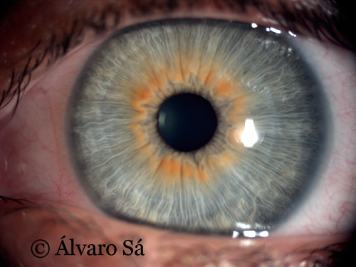 [1BH3VCTE1RBEM95B_7003478_00.JPG]