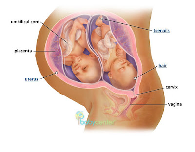31 Weeks Pregnant with Twins