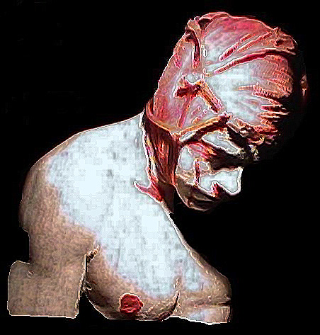 [homem.JPG]