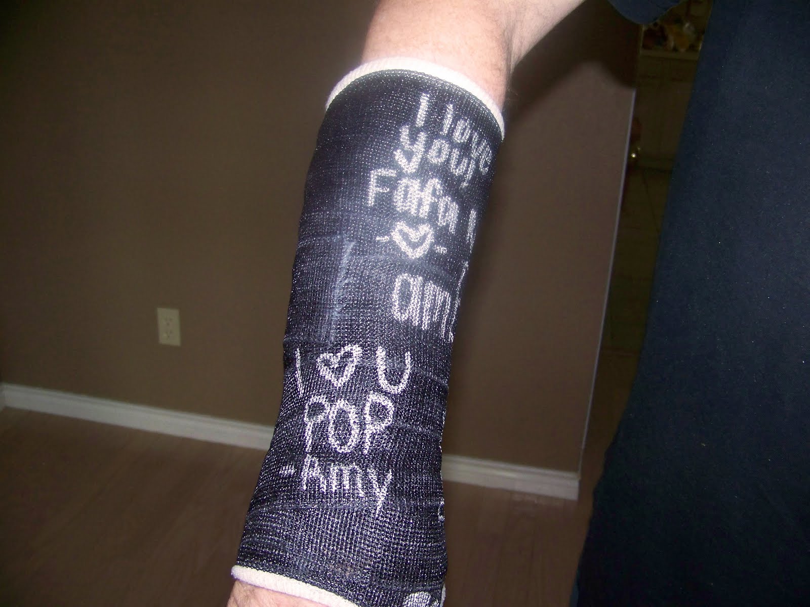 [Right-Arm+Cast.jpg]