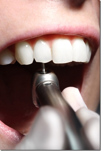 broca+do+dentista_thumb%255B1%255D.jpg