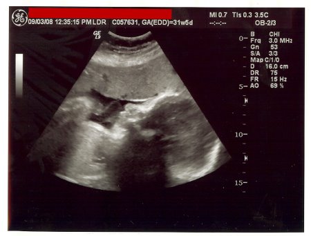 [31wk5dussmall02.jpg]