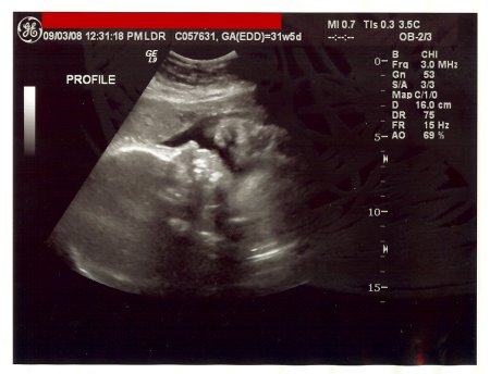 [31wk5dussmall01.jpg]