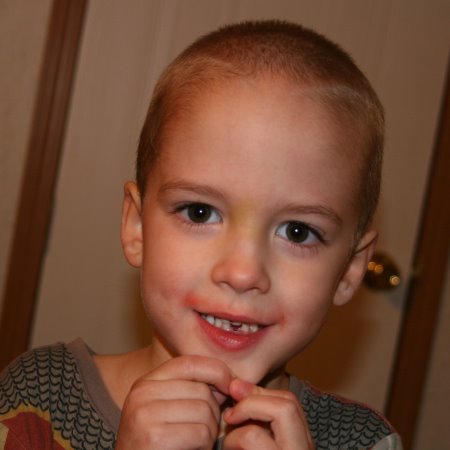 [zs1stmissingtooth.jpg]