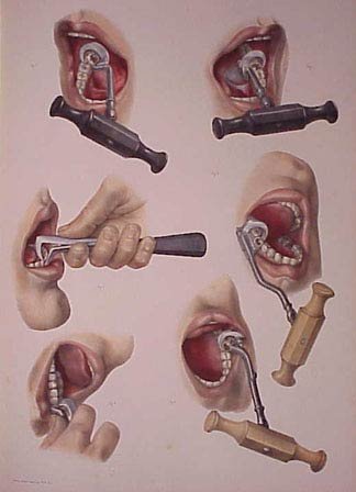 [history-of-dentistry-07.jpg]