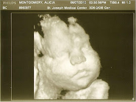 Whitney's ultrasound 45 Days Prior to birth