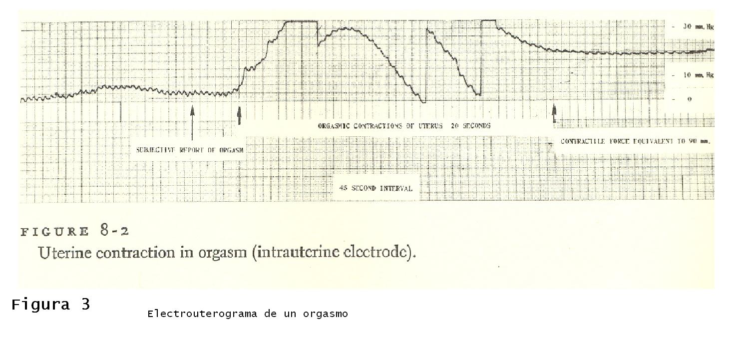 [Electrouterog..JPG]