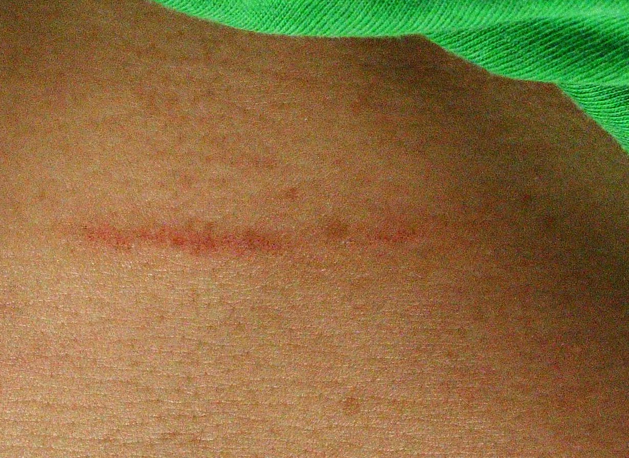 What to Wear Running Running and Chafing