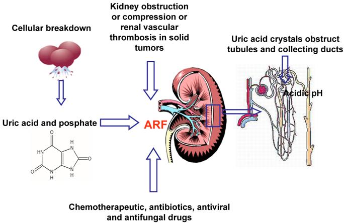 Acute Renal