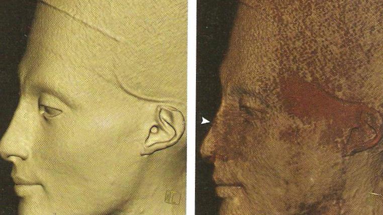 [Nefertiti+Nose.jpg]