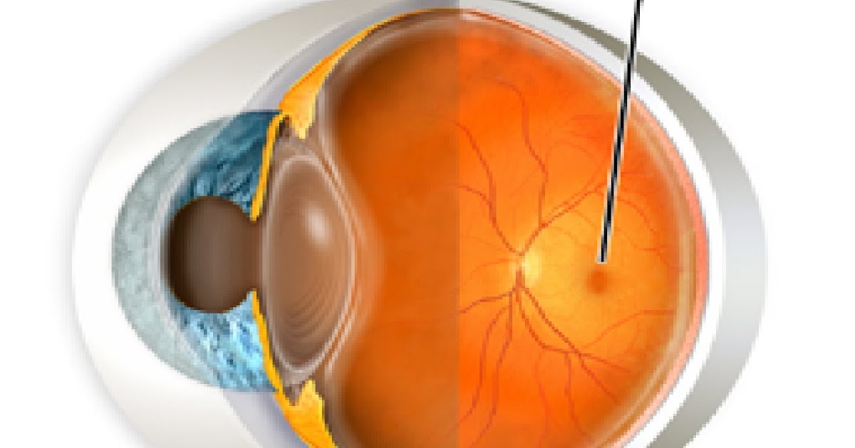 Health Mirror Cataracts and Macular Degeneration
