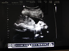 Simeon D. is coming in November