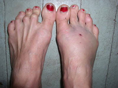 jennifer lopez feet