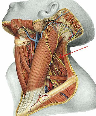 Nervio Accesorio; Nervio Craneal XI; XI Par Craneal; XI Nervio Craneal