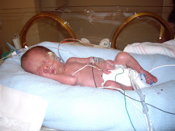 Jaden- 1 week old