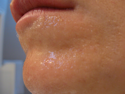 Chin Pores