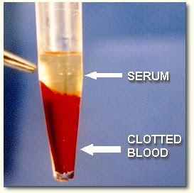 plasma suero darah sangue astrovet sanguineo nha fluid disebut centrifuge perbedaan preparation medimoon bismillah