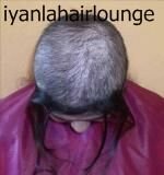 hair replacement weave