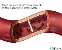 High Pressure on blood vessels