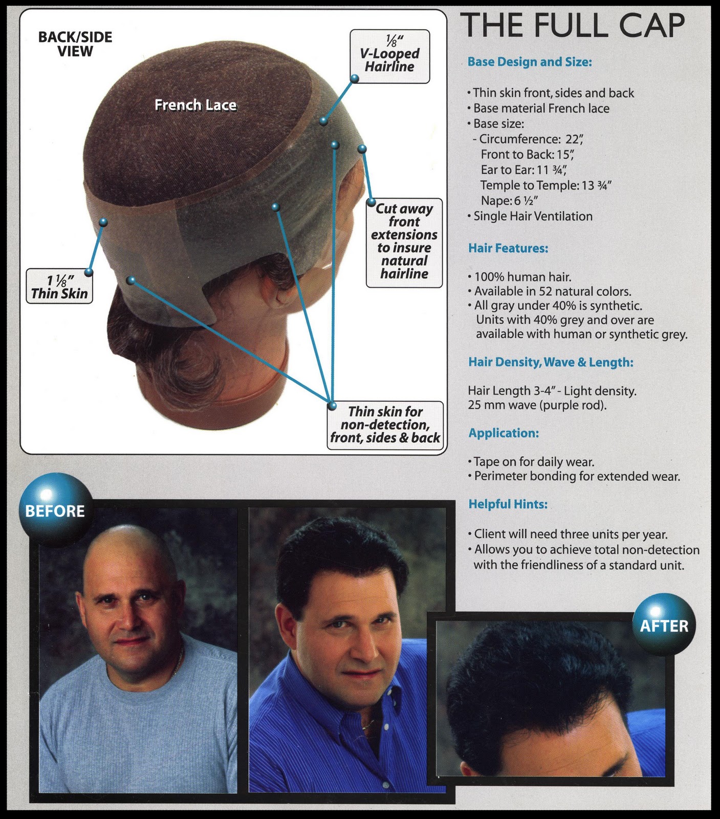 Fashionnfreak Hair Loss Solution