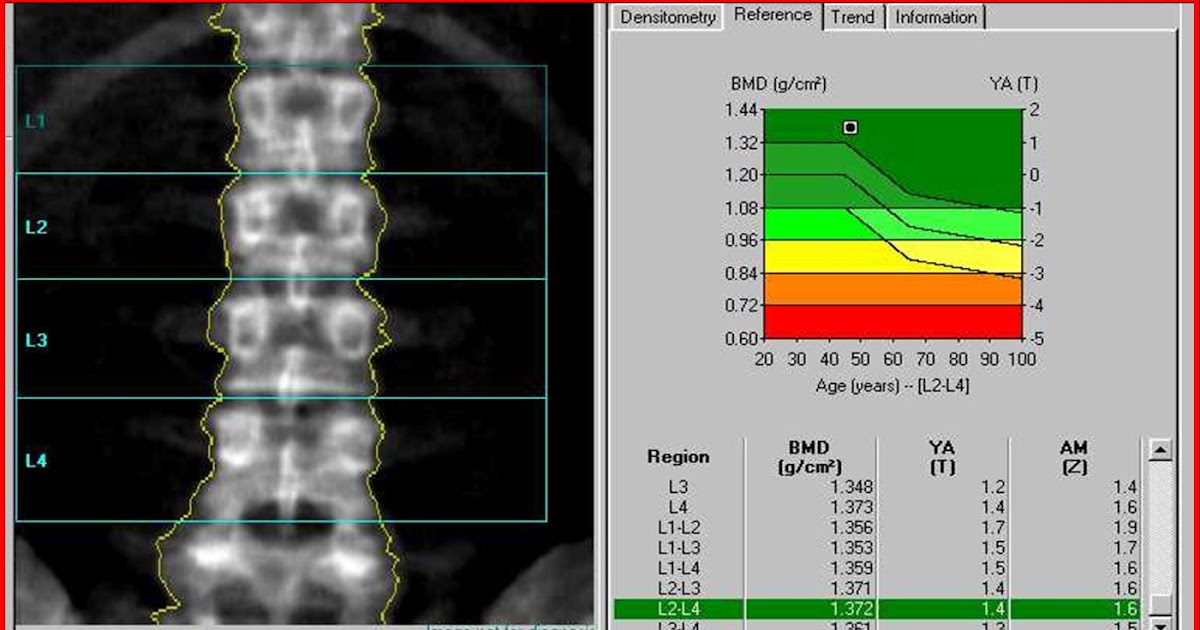 DİŞ TOMOGRAFİSİ DENTAL 3D VOLUMETRİK GÖRÜNTÜLEME VE GÖRÜNTÜLEME