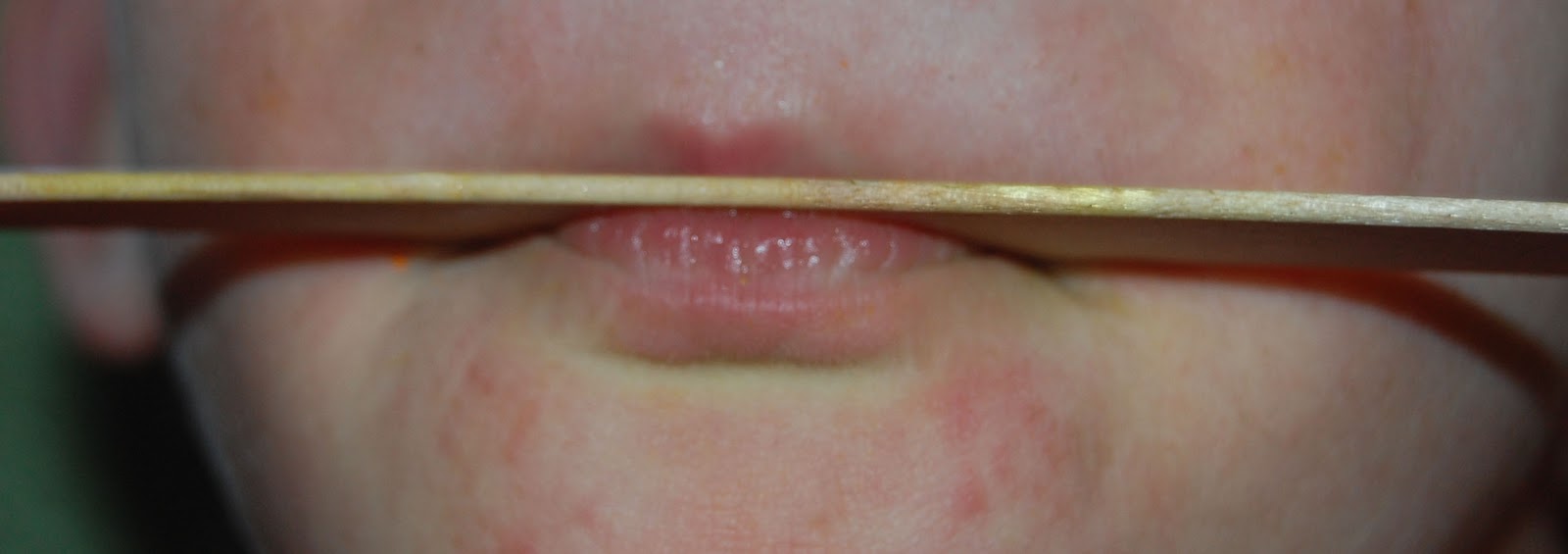 Got Down Syndrome's Blog Strengthening the Lips