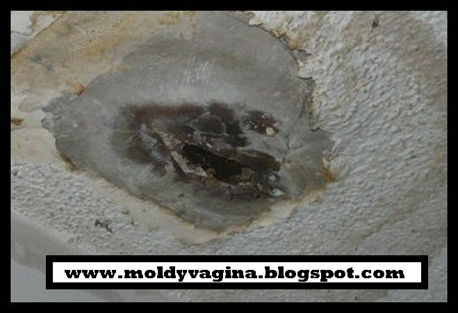 The moldy vagina