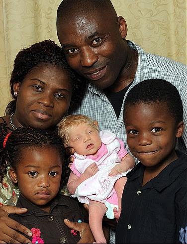 Passion4fashiontz Black British Couple Give Birth To White Blue