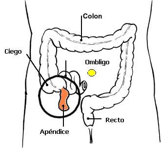 APENDICITIS AGUDA...todo lo que se debe preguntar y saber...: ¿QUE ES