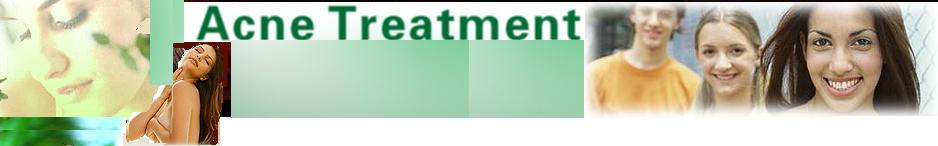 Acne treatment Guides