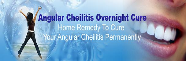 Angular Cheilitis Review